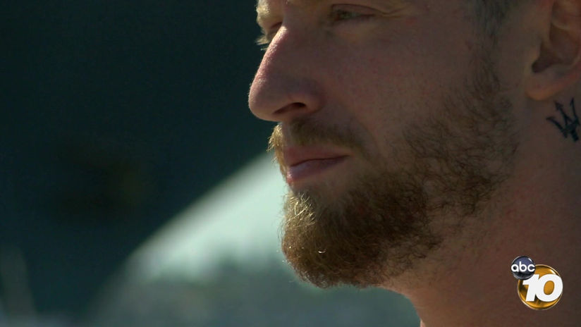 10NEWS SUNKEN LEG STORY